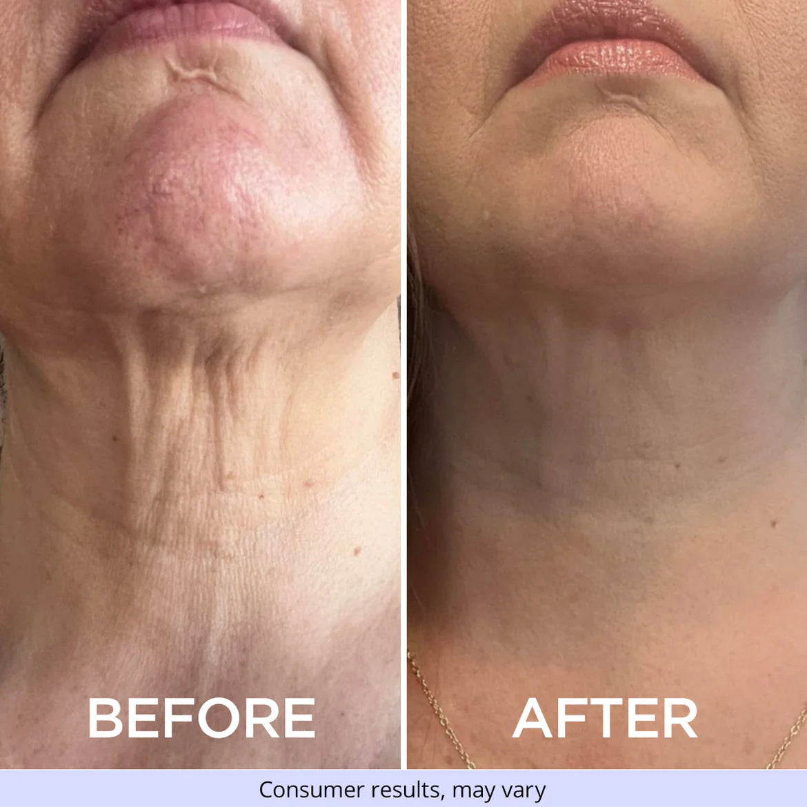 Tighten & Lift Neck Cream.