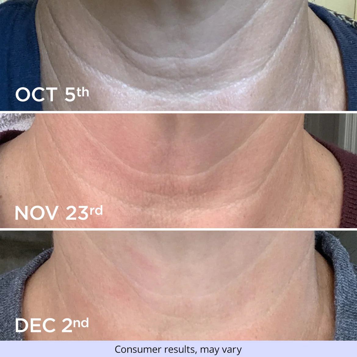 Tighten & Lift Neck Cream.